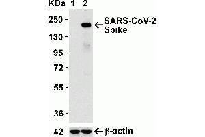 Overexpression Validation in Spike Transfected 293 Cells.