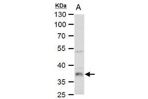 WB Image LDH-B antibody detects LDH-B protein by western blot analysis.