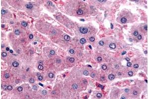 Human Liver (formalin-fixed, paraffin-embedded) stained with DPP9 antibody ABIN364226 at 20 ug/ml followed by biotinylated goat anti-rabbit IgG secondary antibody ABIN481713, alkaline phosphatase-streptavidin and chromogen.