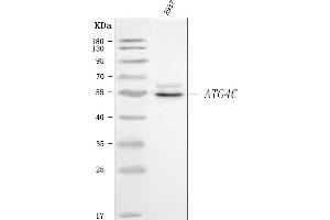 Western blot analysis of ATG4C using anti-ATG4C antibody (ABIN7599415).