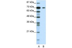 WB Suggested Anti-KLHL26  Antibody Titration: 1.