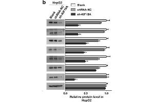 The expression of KIF18A and other signal pathway-related proteins in hepatoma cells.