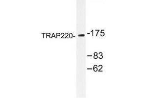 Image no. 1 for anti-Mediator Complex Subunit 1 (MED1) antibody (ABIN272236) (MED1 anticorps)