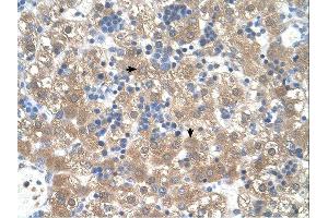 PEX3 antibody was used for immunohistochemistry at a concentration of 4-8 ug/ml.