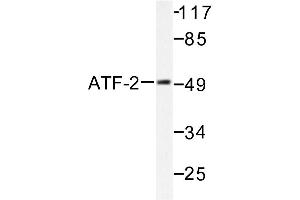 Image no. 1 for anti-Activating Transcription Factor 2 (ATF2) antibody (ABIN265321) (ATF2 anticorps)