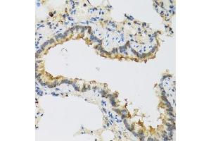 Immunohistochemistry of paraffin-embedded rat lung using FAM20A antibody. (FAM20A anticorps  (AA 140-240))