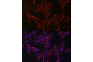 Immunofluorescence analysis of C6 cells using DUSP6 Rabbit pAb (ABIN3017520, ABIN3017521, ABIN3017522 and ABIN6220131) at dilution of 1:100 (40x lens).