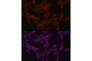 Immunofluorescence analysis of C6 cells using DUSP6 Rabbit pAb (ABIN3017520, ABIN3017521, ABIN3017522 and ABIN6220131) at dilution of 1:100 (40x lens). (DUSP6 anticorps  (AA 1-170))