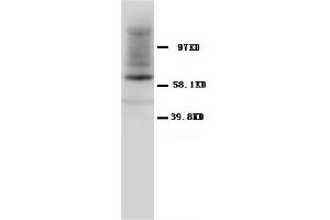 Western Blotting (WB) image for anti-Heat Shock 60kDa Protein 1 (Chaperonin) (HSPD1) antibody (ABIN1107605) (HSPD1 anticorps)