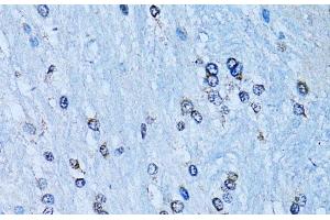 Immunohistochemistry of paraffin-embedded Rat brain using NFkB p100 / p52 Polyclonal Antibody at dilution of 1:100 (40x lens). (NFKB2 anticorps)