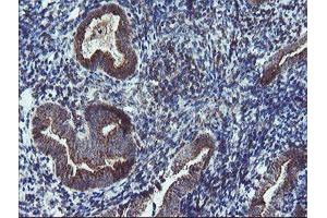 anti-Diphthamide Biosynthesis Protein 2 (DPH2) antibody