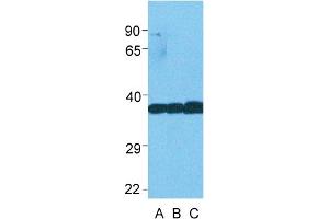 Host:  Rabbit  Target Name:  LDHB  Sample Type:   Lane A: Human Fetal Lung  Lane B: Human HCT116  Lane C: Human 293T  Antibody Dilution:  0.