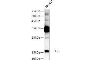 Western blot analysis of extracts of HepG2 cells, using TTR antibody (ABIN3021473, ABIN3021474, ABIN3021475 and ABIN6215107) at 1:1000 dilution. (TTR anticorps  (AA 21-147))