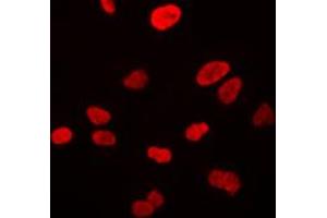 Immunofluorescent analysis of VWA5A staining in HeLa cells.