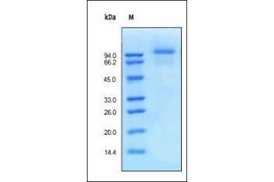 SDS-PAGE (SDS) image for Epidermal Growth Factor Receptor (EGFR) (AA 25-645) (Active) protein (His tag) (ABIN6253725)