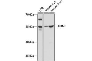 Western blot analysis of extracts of various cell lines, using KDM8 antibody (ABIN6128146, ABIN6142814, ABIN6142815 and ABIN6215293) at 1:3000 dilution. (JMJD5 anticorps  (AA 147-416))