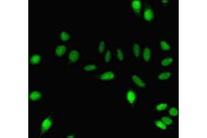 Immunofluorescent analysis of A549 cells using ABIN7150825 at dilution of 1:100 and Alexa Fluor 488-congugated AffiniPure Goat Anti-Rabbit IgG(H+L)