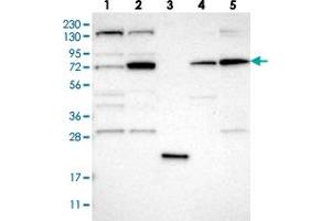 Western blot analysis of Lane 1: RT-4, Lane 2: U-251 MG, Lane 3: Human Plasma, Lane 4: Liver, Lane 5: Tonsil with DNAJC14 polyclonal antibody  at 1:250-1:500 dilution.