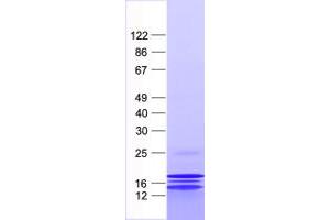 Validation with Western Blot (RPL31 Protein (His tag))