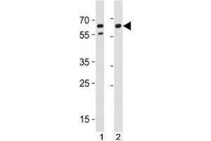 CD46 antibody western blot analysis in A549,HeLa lysate