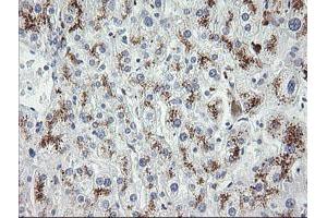 Image no. 3 for anti-Mdm4-binding Protein (MDM4) antibody (ABIN1499353)