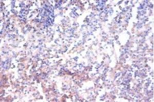 Immunohistochemistry of paraffin-embedded human spleen tissue using ABIN7143162 at dilution of 1:100