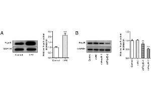 Fxyd5 silencing enhances cell viability and inhibits cell apoptosis and ECM degradation in ATDC5 cells. (FXYD5 anticorps  (N-Term))