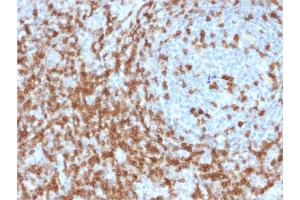 Formalin-fixed, paraffin-embedded human Tonsil stained with CD5 Mouse Monoclonal Antibody (CD5/2419). (CD5 anticorps  (AA 269-366))