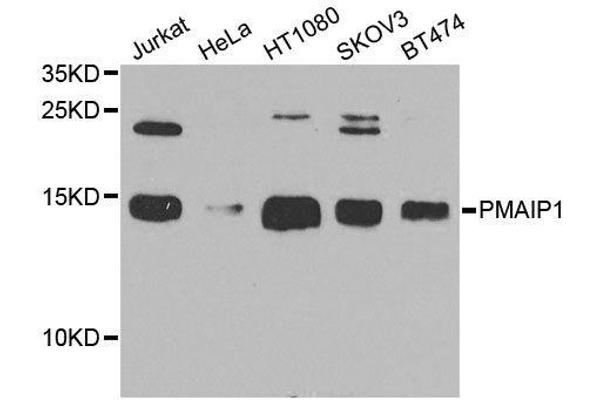 NOXA 抗体  (AA 1-54)