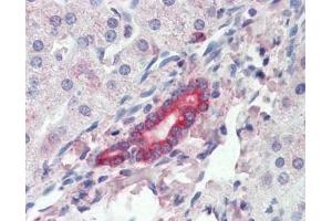 IHC testing of FFPE human liver tissue with ROR1 antibody at 3ug/ml. (ROR1 anticorps)