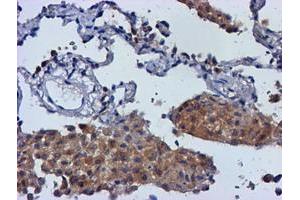 Image no. 2 for anti-Monoglyceride Lipase (MGLL) antibody (ABIN1499443) (MGLL anticorps)