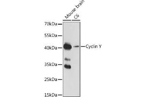 Western blot analysis of extracts of various cell lines, using Cyclin Y antibody (ABIN7266575) at 1:1000 dilution. (Cyclin Y anticorps  (AA 60-120))