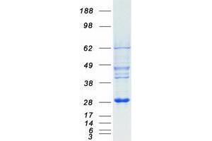 Validation with Western Blot