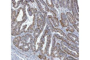 IHC analysis of GLUD1/2 using anti-GLUD1/2 antibody (ABIN7602000). (GLUD1 / GLUD2 (AA 54-553) anticorps)