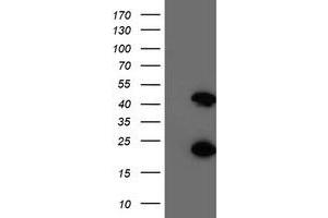 Western Blotting (WB) image for anti-Centromere Protein H (CENPH) antibody (ABIN1497473) (CENPH anticorps)