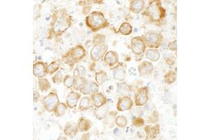 Immunohistochemistry (IHC) image for anti-Cytoskeleton-Associated Protein 4 (CKAP4) (AA 500-550) antibody (ABIN7448940)