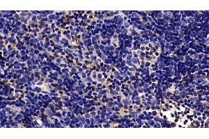 Detection of TLR5 in Rat Lymph node Tissue using Polyclonal Antibody to Toll Like Receptor 5 (TLR5)