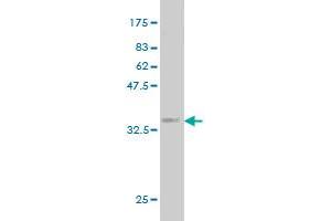 Western Blot detection against Immunogen (32.