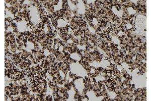 ABIN6272551 at 1/100 staining Rat lung tissue by IHC-P. (PPP1R9B anticorps  (C-Term))