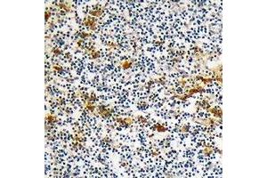 Immunohistochemical analysis of DOK6 staining in human lymph node formalin fixed paraffin embedded tissue section. (DOK6 anticorps)