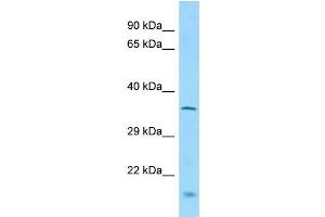 Host:  Rabbit  Target Name:  Mctp1  Sample Type:  Mouse Lung lysates  Antibody Dilution:  1. (MCTP1 anticorps  (N-Term))