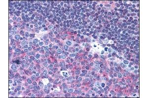 Immunohistochemistry (IHC) image for anti-CD40 (CD40) antibody (ABIN400699) (CD40 anticorps)