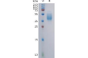 Human Protein, mFc Tag on SDS-PAGE under reducing condition.