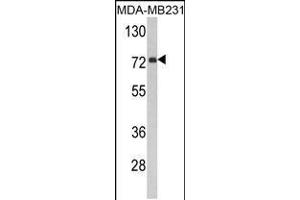 Western blot analysis of FMO3 Antibody in MDA-MB231 cell line lysates (35ug/lane) (FMO3 anticorps  (N-Term))