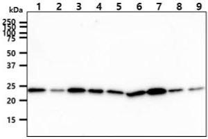 The cell lysates (40ug) were resolved by SDS-PAGE, transferred to PVDF membrane and probed with anti-human CINP antibody (1:1000). (CINP anticorps)