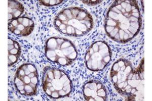 Image no. 4 for anti-Cytidine Monophosphate (UMP-CMP) Kinase 1, Cytosolic (CMPK1) antibody (ABIN1497546)