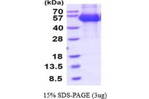 SDS-PAGE (SDS) image for Interferon alpha/beta Receptor 1 (IFNAR1) (AA 27-429) protein (His tag) (ABIN7281163)