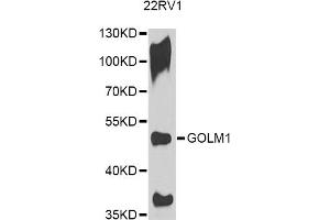 Western blot analysis of extracts of 22RV1 cells, using GOLM1 antibody. (GOLM1 anticorps)