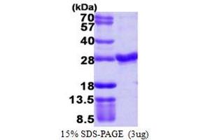 SDS-PAGE (SDS) image for RAB4A, Member RAS Oncogene Family (RAB4A) (AA 1-218) protein (His tag) (ABIN667483)