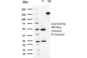 anti-S100 Calcium Binding Protein A4 (S100A4) antibody